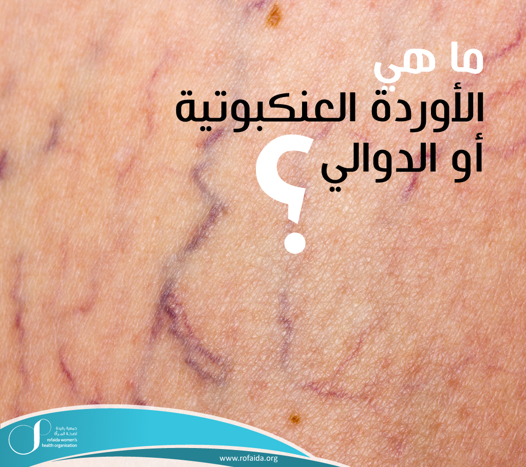 ما-هي-الأوردة-العنكبوتية.jpg